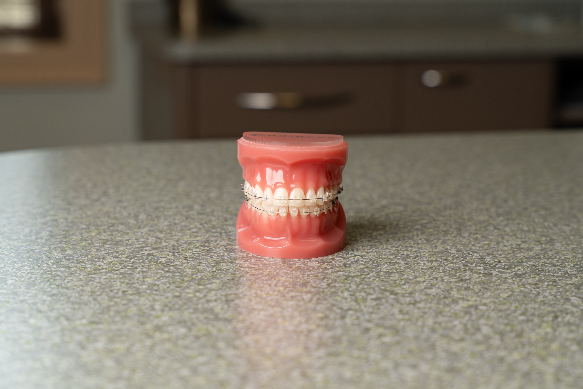 Clear Braces